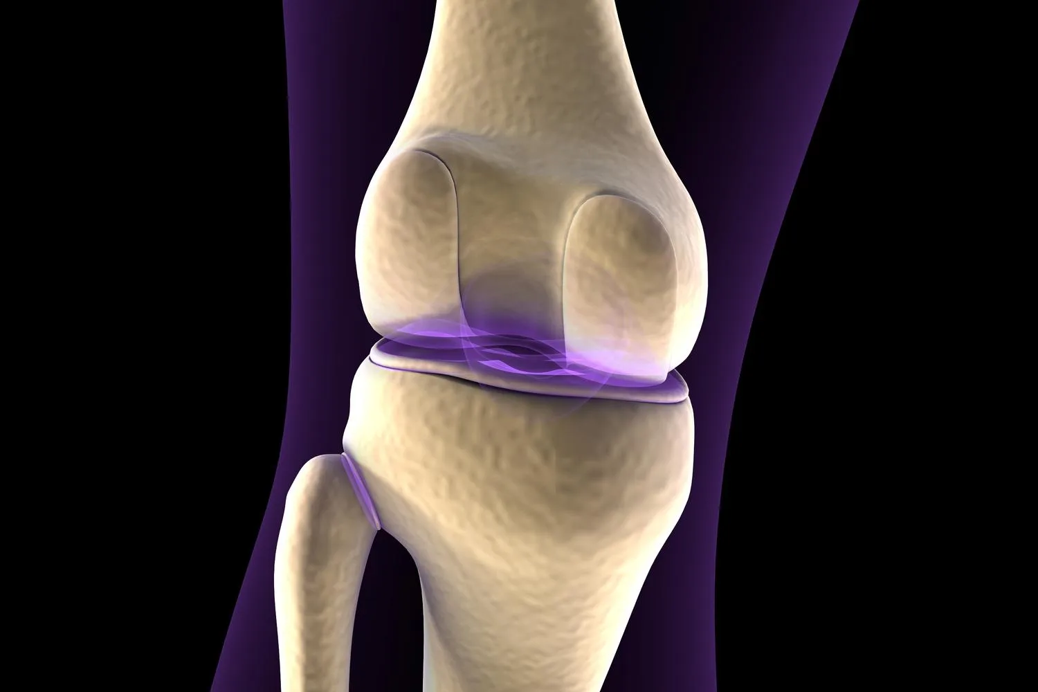 Recupera tu Movilidad: Cirugía de prótesis de rodilla en Guadalajara, Jal
